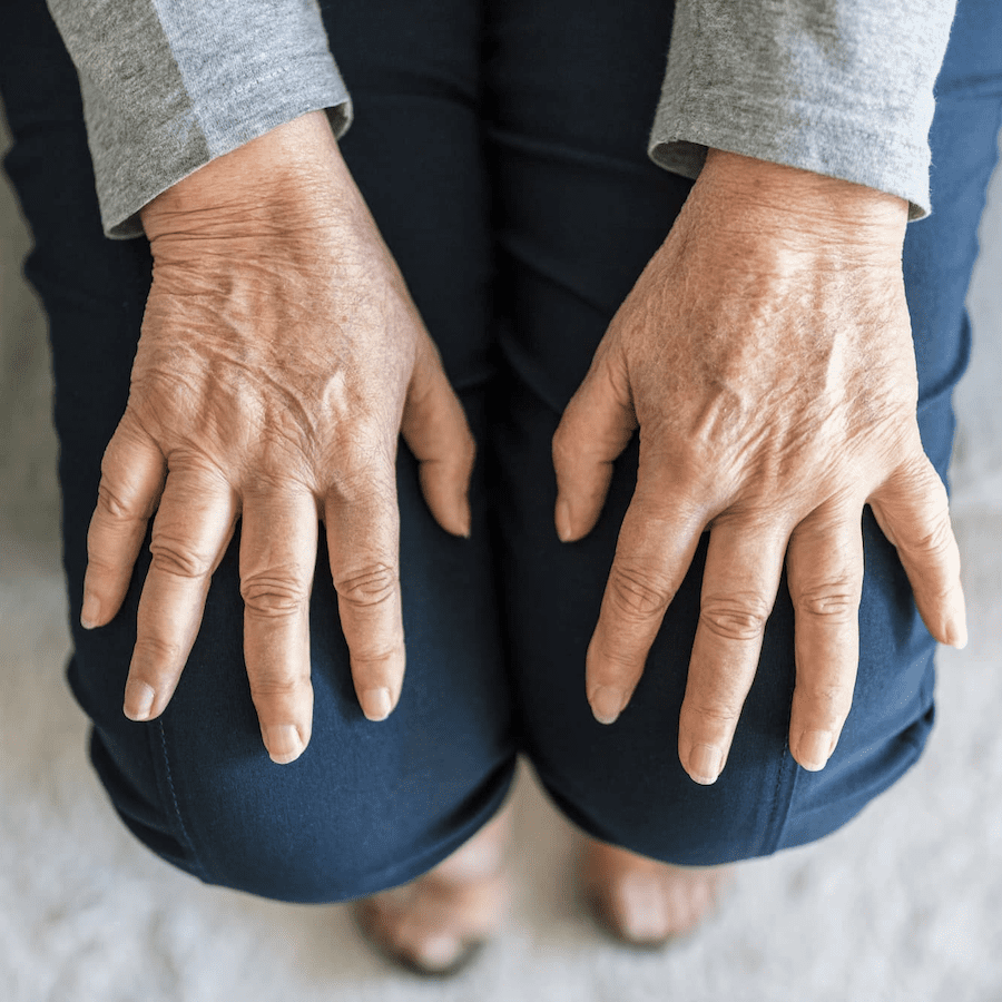 Psoriatic Arthritis clinical trial